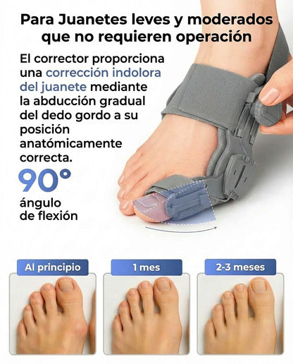 Corrector de Juanete con Perilla gradual ajustable (1 un)